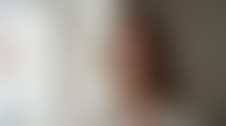 How to Look Younger Without Fillers in London: The 2026 Natural Rejuvenation Guide