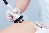 radiofrequency-therapy-05.jpg