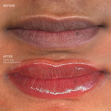 Dark-lip-neutralisation-pmuparlour-Warrington-cheshire
