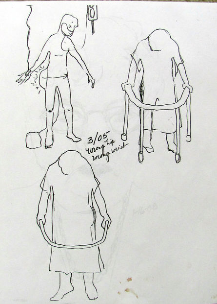 17- 1987 - AFTER THE ACCIDENT .JPG