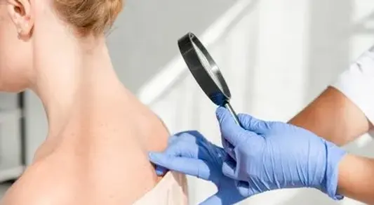 430x243-dermatoloji-hangi-hastaliklara-bakar-cildiye-dermatoloji-bolumu-nedir-ve-neye-baka