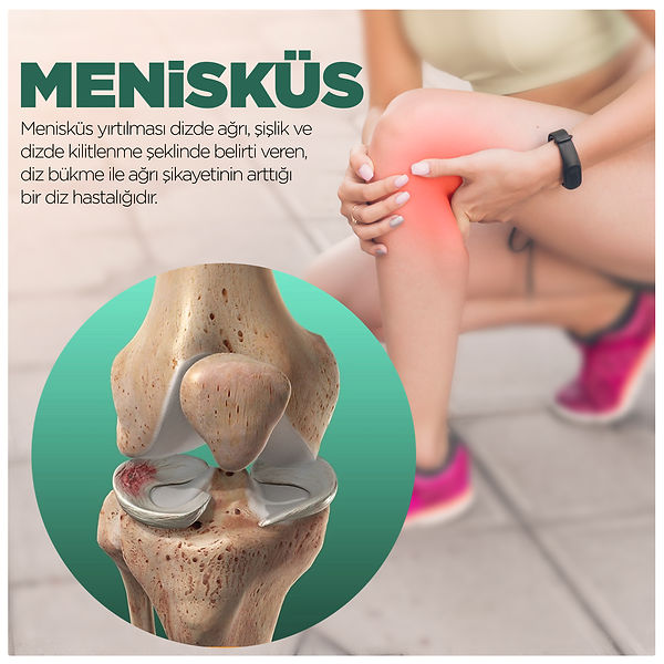 MENISKUS.jpg