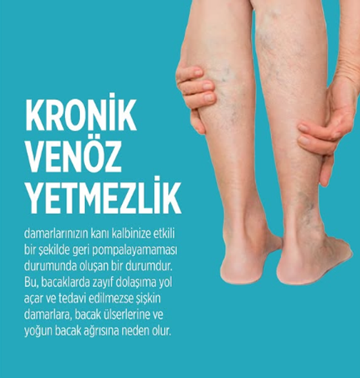 krvy.png