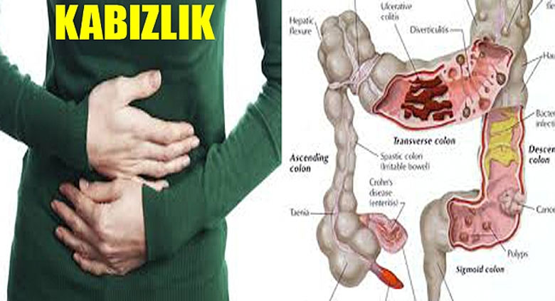 kabizlik-sorunu-yasiyorsaniz-en-etkili-cozum-yontemleri.jpg