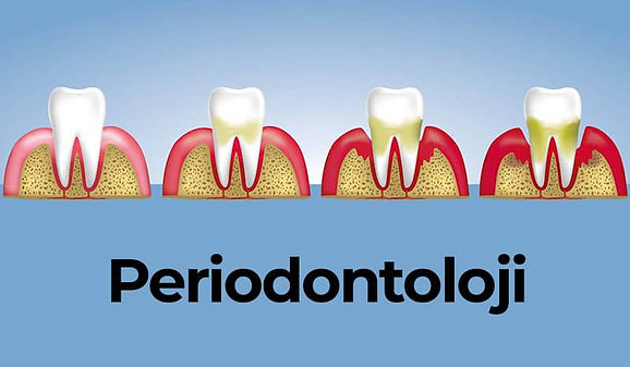 Periodontoloji-nedir.jpg