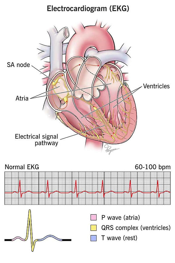 EKG2.jpg