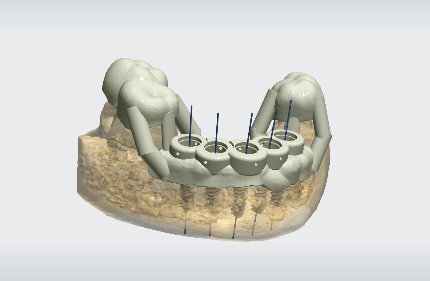 Lab United States S2 Digital Dental Lab