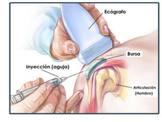 Tratamiento Regenerativo