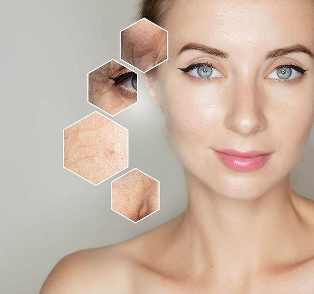 Morpheus8 Face | Dr. Michael Nagy | Plastic Surgery of the Face