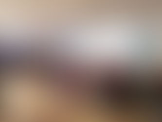 Gobierno estatal impulsa jornada de valoración en pacientes con labio paladar hendido