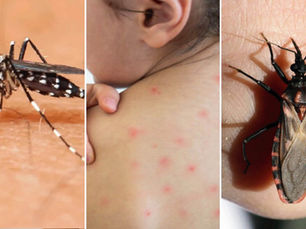 Autoridades sanitarias emiten alerta por chinche besucona, transmisora de la enfermedad de Chagas, en municipios de San Luis Potosí