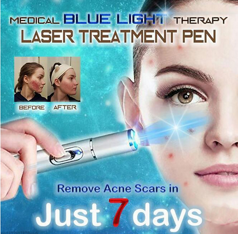 bleu_laser_7days.png