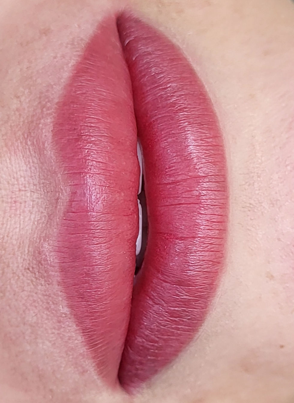 Miniatura: Lip Blush Enhancement