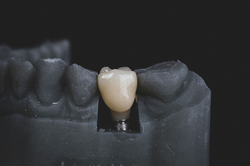A close-up of a dental model with a single tooth implant in place. The model is dark gray with an off-white tooth, set on a black background.