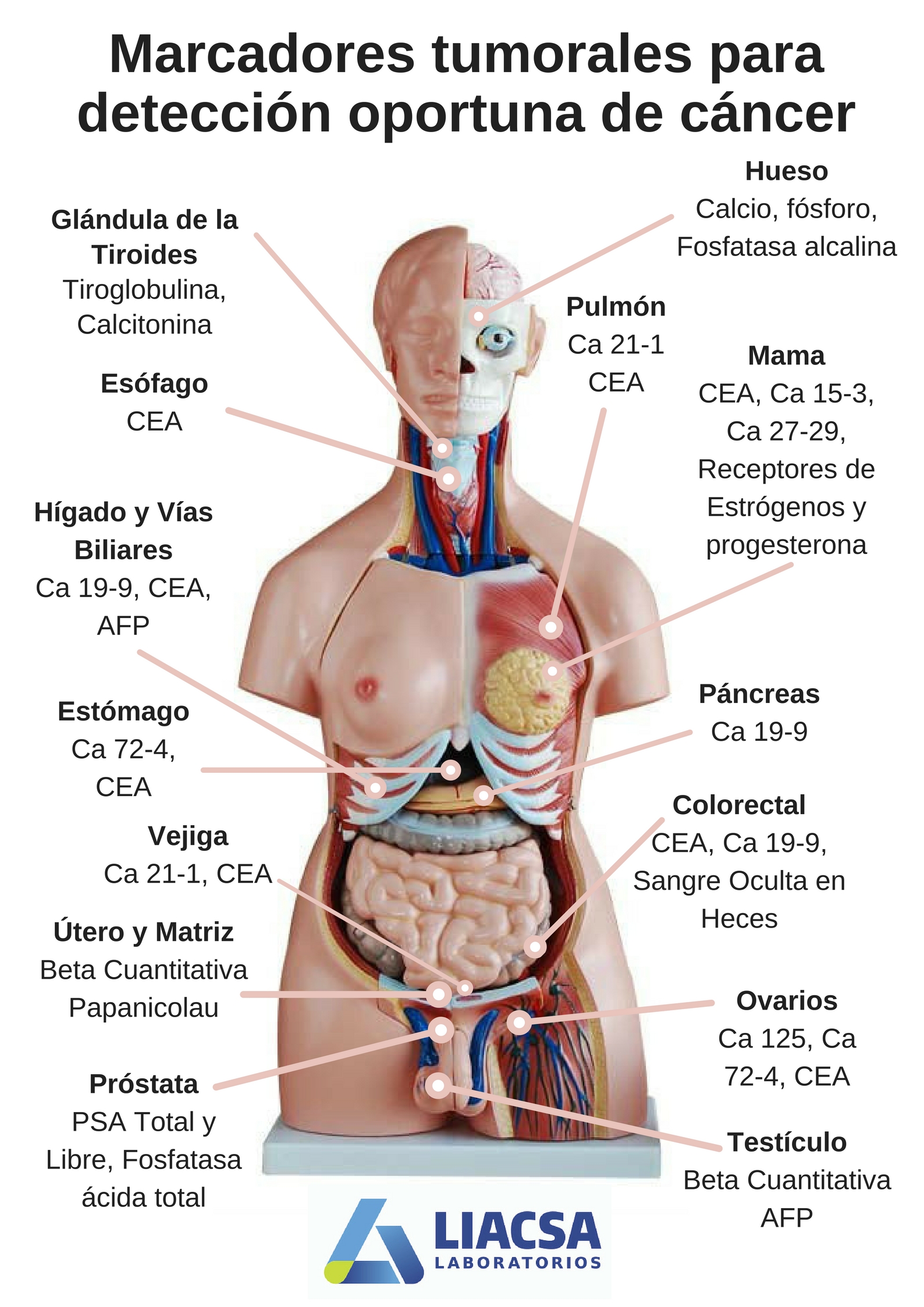 cea de prostata cea de prostata