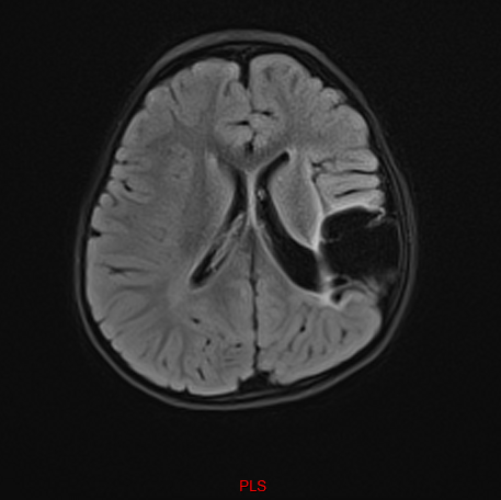 Scan of Penelopes Brain