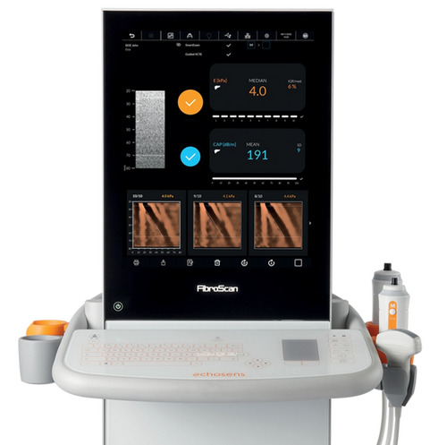FibroScan® Expert 630