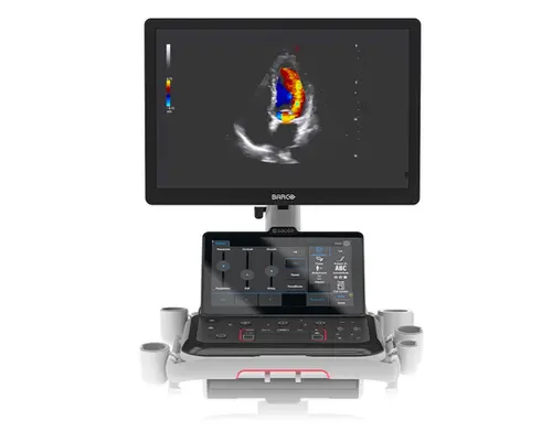 Ultrasonido MyLab™A70