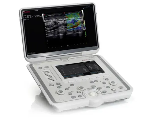 Ultrasonido MyLab Omega
