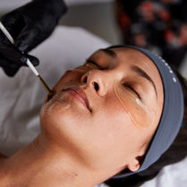 Professional administering a chemical peel treatment using AlumierMD products on a client's skin. The process involves a controlled application of specialized solutions to exfoliate and rejuvenate the skin, revealing a fresh, glowing complexion underneath. The client is comfortably reclined, undergoing the procedure in a spa-like environment.