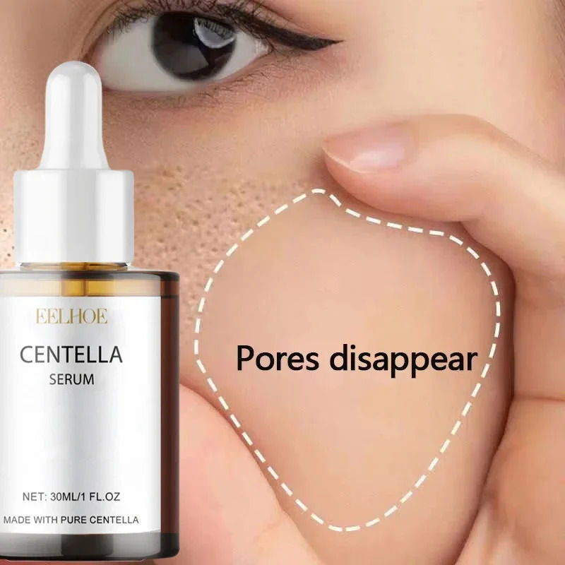 Centella Asiatica Face Serum Nourish Dry Skin Smoothing Rejuvenation Skin Bright