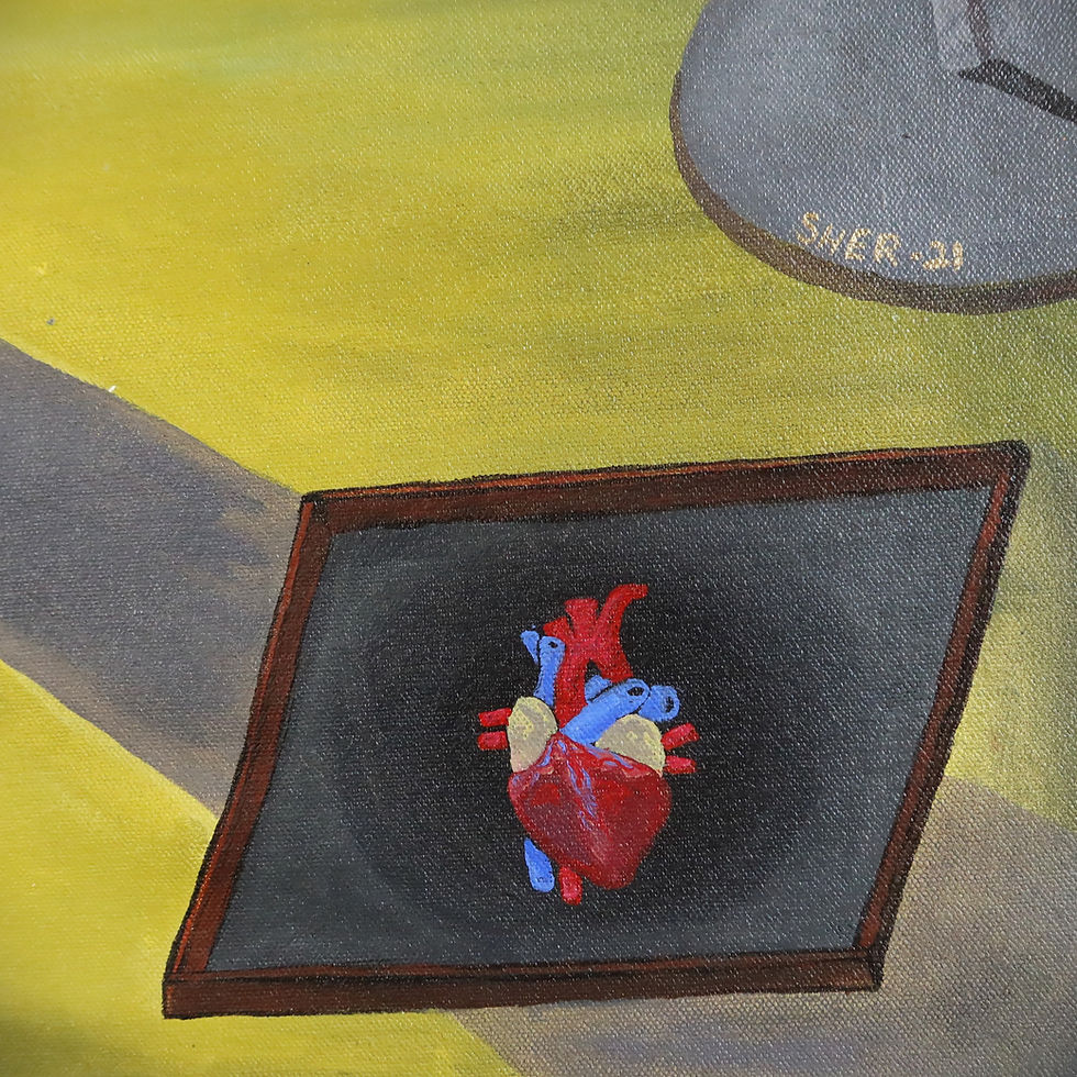 "Glass Eye" by Sherrill Sejpal