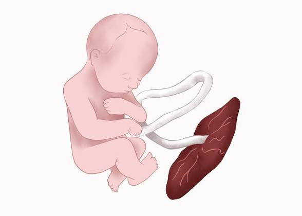 Placental Location and Mode of Delivery: Does the Position of the Placenta Decide How You Will Deliver?