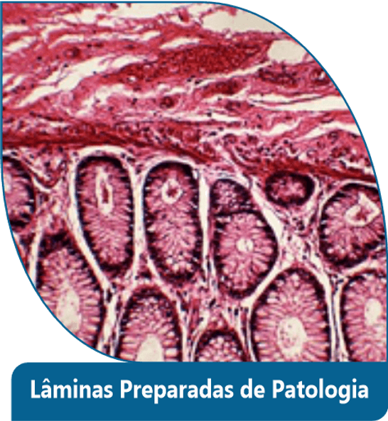 Lâminas Preparadas de Patologia