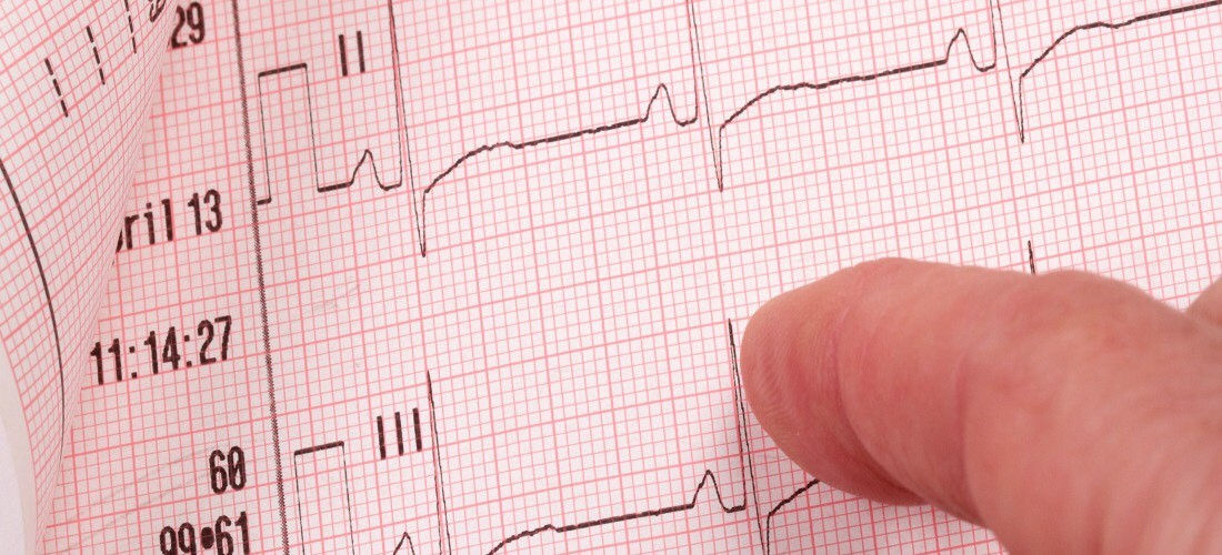 Sunday 29th March 2026 12 Lead ECG