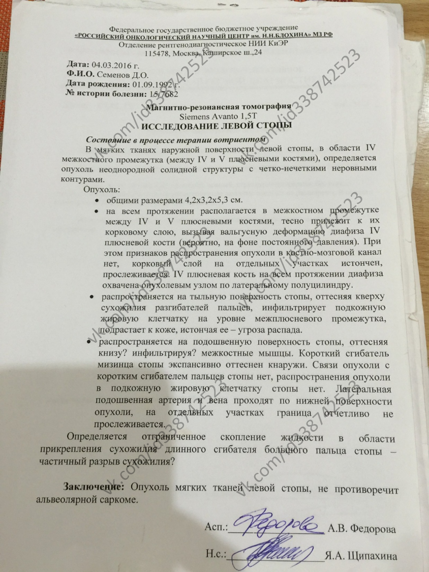 АО (11)