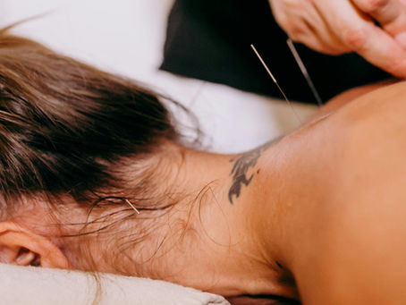 In-Home Dry Needling and Physical Therapy in Boca Raton & Surrounding Areas: