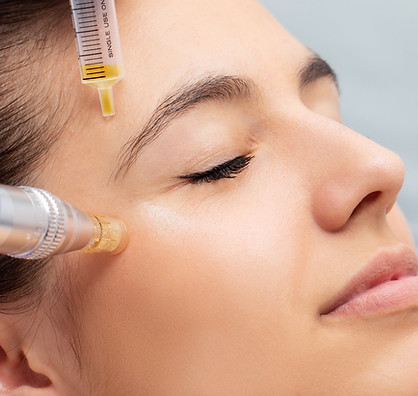 Revitaliza tu rostro con tu propio plasma. Estimula colágeno y mejora la textura de la piel.