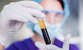 Tratamiento natural que utiliza tu propio plasma para hidratar, regenerar y bioestimular la piel, logrando un rostro más lumi