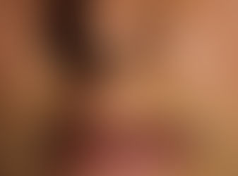 Is that a Cold Sore? Prevention and Treatment