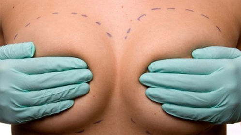 Estetica, tra i trend del 2017 sarà boom di ritocchi naso e seno