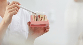 Should you get dental implants? Find out here