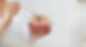 Dental implant treatment