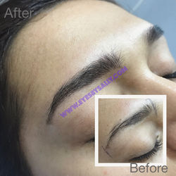 Best San Francisco Microblader