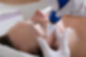microneedling-skinpen.jpg