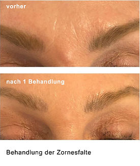 vorher-nachher-faden-1.jpg