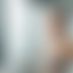 Paciente pós-Ozempic em tratamento estético não invasivo para flacidez e contorno corporal.