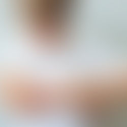 Criança recebendo primeiros socorros após picada de abelha