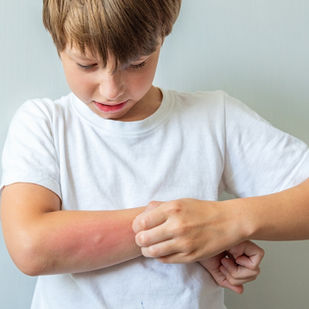 Criança recebendo primeiros socorros após picada de abelha