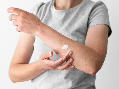Pessoa cuidando da pele no inverno, com foco em dermatite, caspa, psoríase e cuidados dermatológicos durante o frio.
