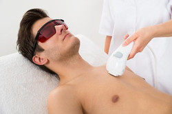 DEPILAZIONE LASER