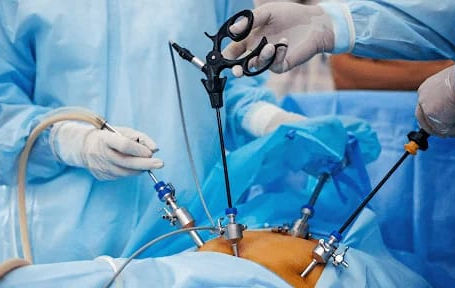 Sob a Maca: A Realidade das Cirurgias Bariátricas em Boa Vista