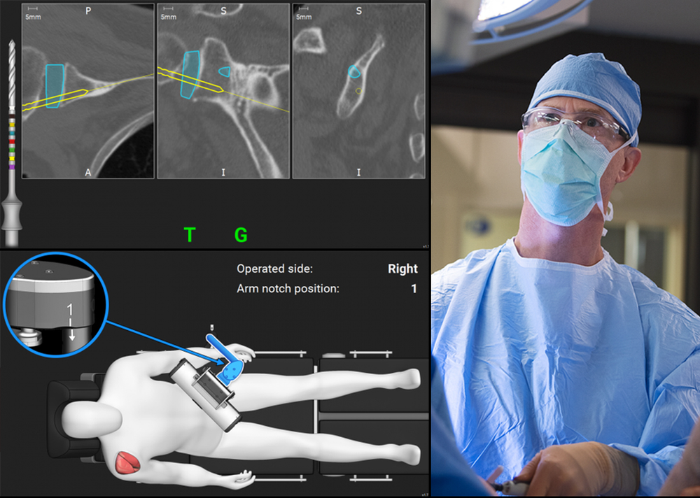 Dr. Kaplan is First Surgeon in the Indiana to Perform Reverse Total