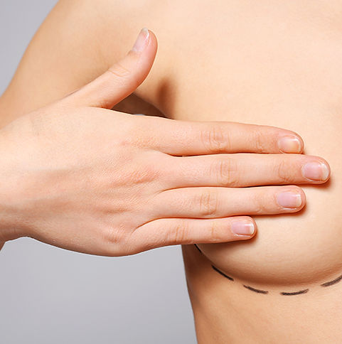 closeup-view-young-woman-with-breasts-marked-plastic-operation-light-background.jpg