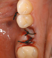 Oral Surgery