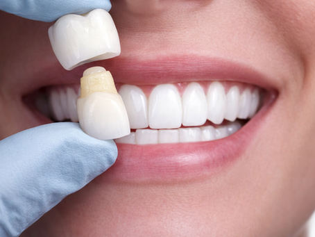Dents usées à Istanbul : causes et traitements